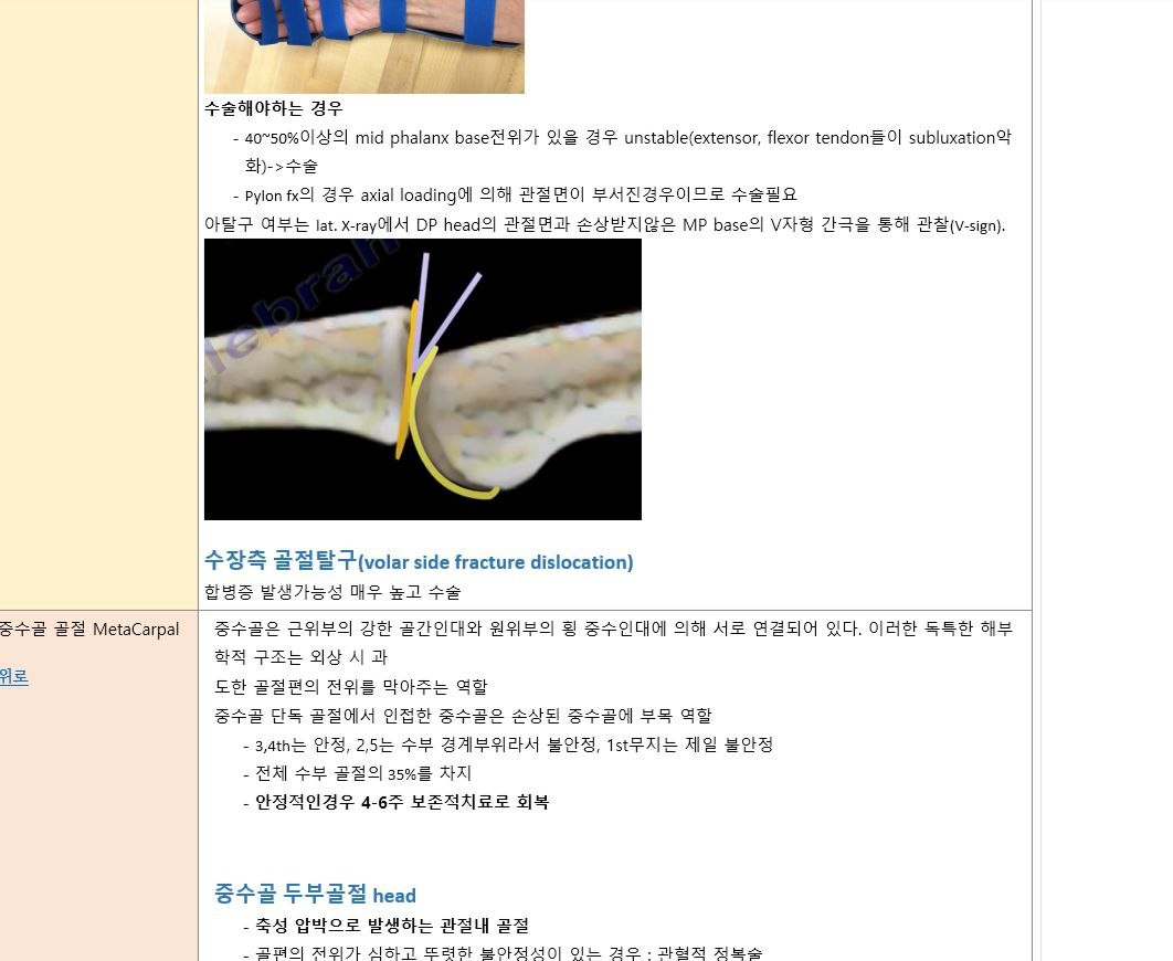 통증 패키지 예시 이미지 6